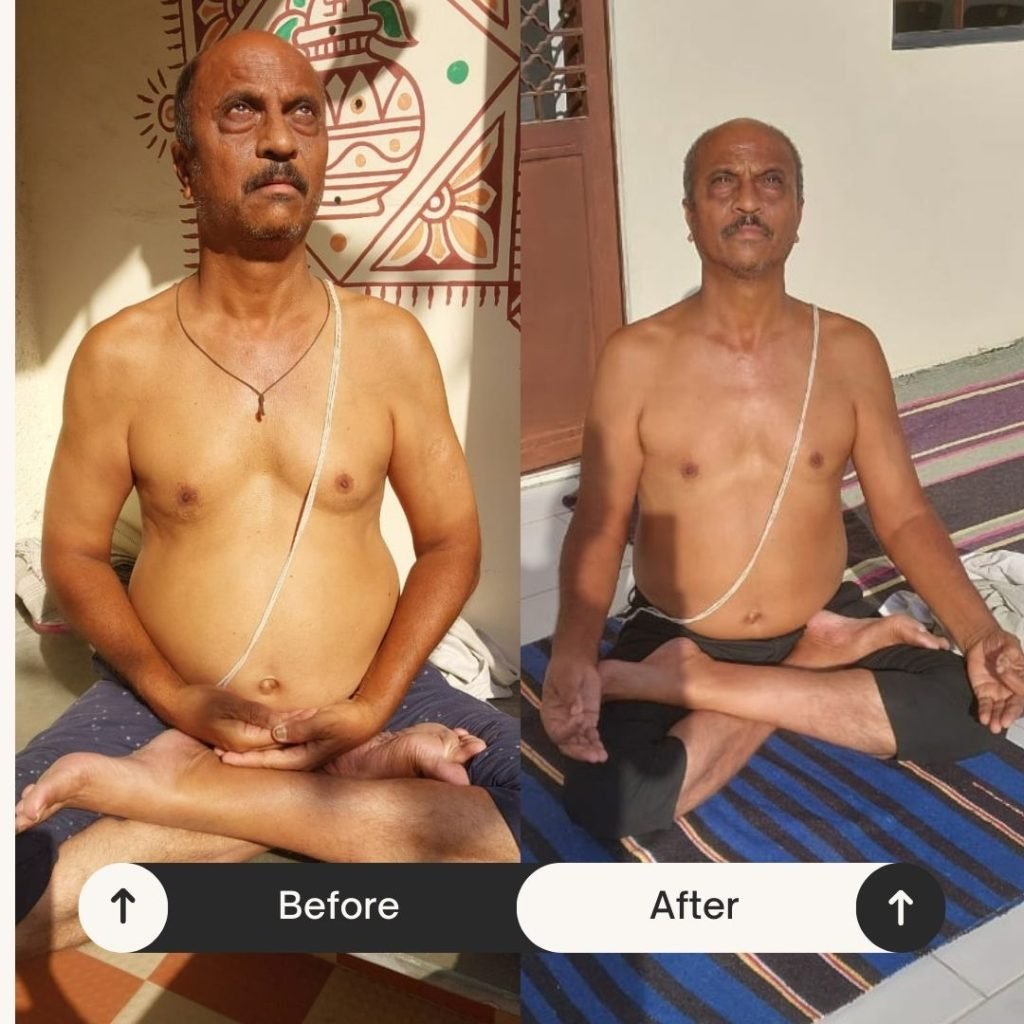 Before-after-After-Sunyoga
